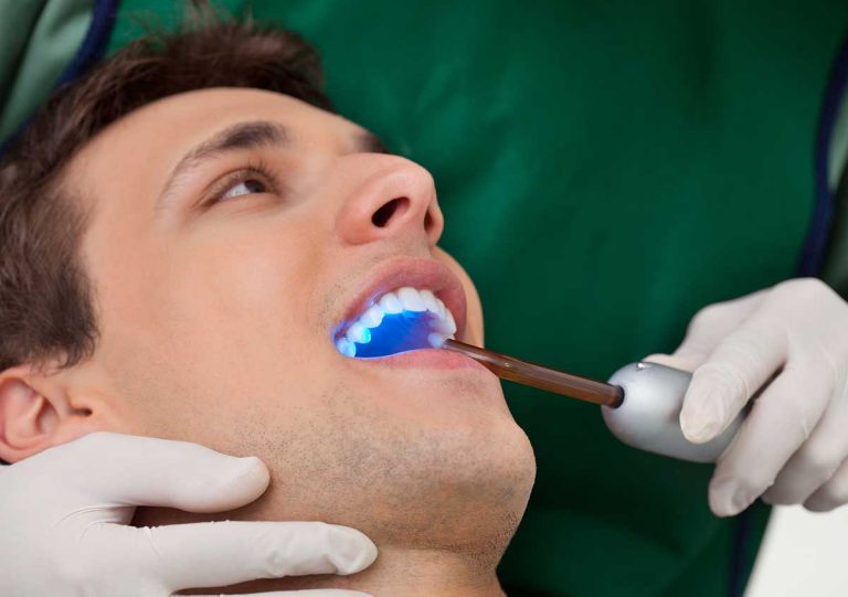 Dentist in Atlanta, GA describes dental bonding