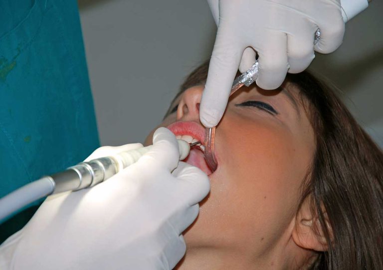 Dental office in Smyrna debunks the myths of root canal treatment