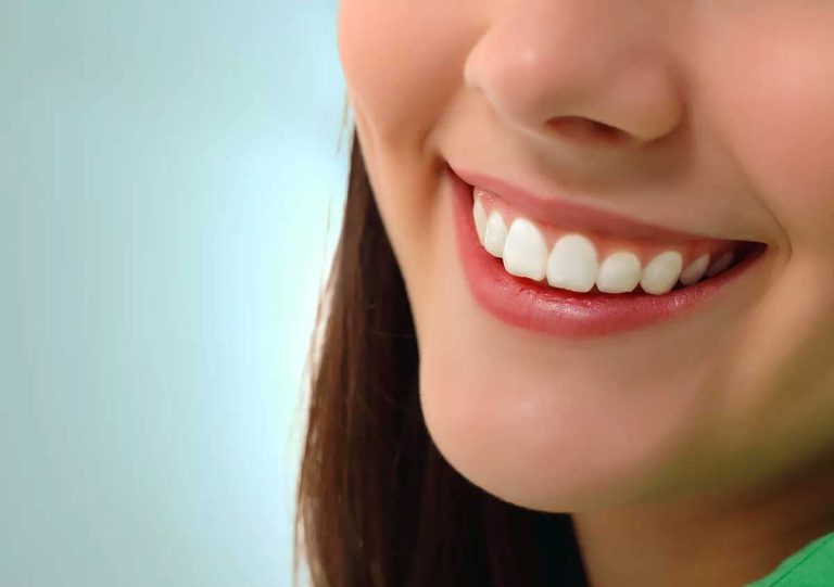 Teeth Whitening Dentist at Smyrna Dental in Smyrna Ga Area
